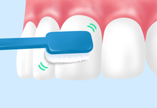 ブラッシング指導