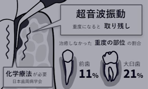 従来の治療